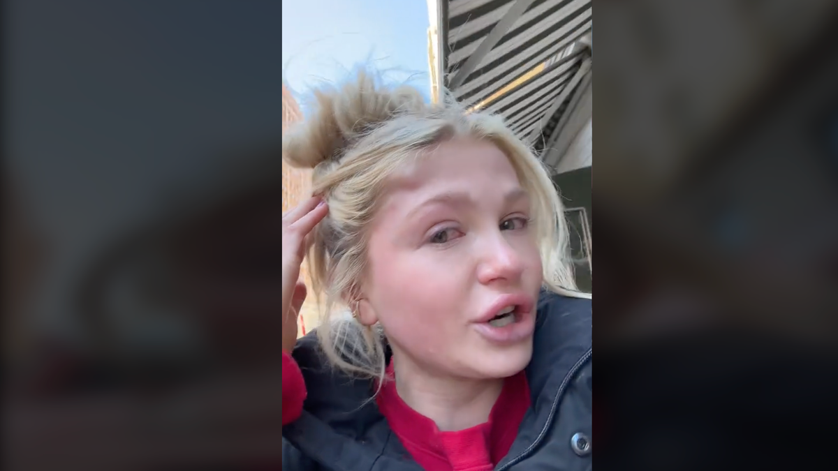 Girl with golf-sized bump on her head in TikTok video.